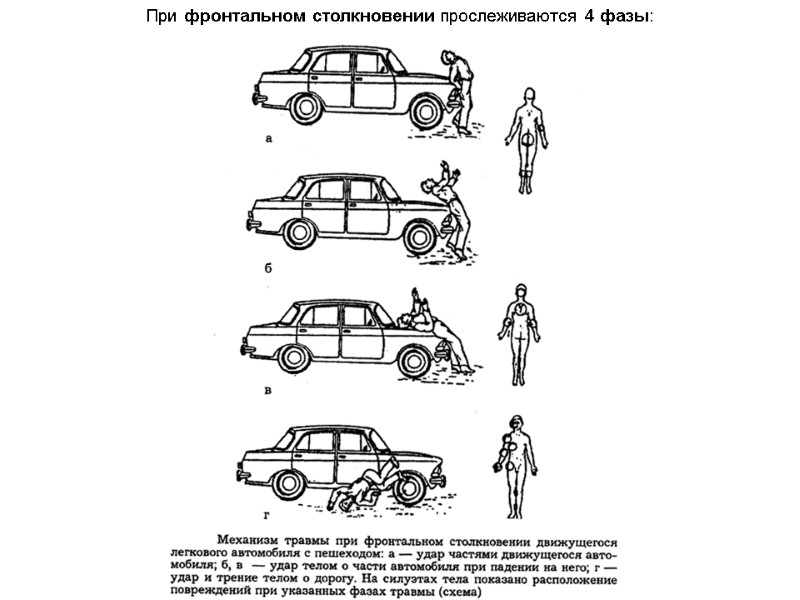 При фронтальном столкновении прослеживаются 4 фазы: